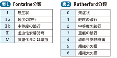 04_39_末梢動脈疾患（PAD）：閉塞性動脈硬化症