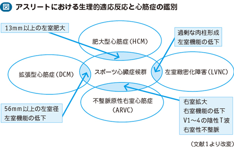 心拍 数 心臓 スポーツ