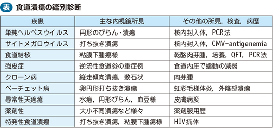 05_02_食道潰瘍