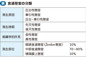 静脈 瘤 分類 食道