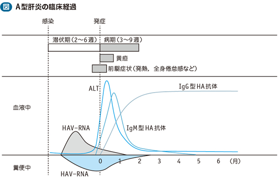 06_01_A型肝炎