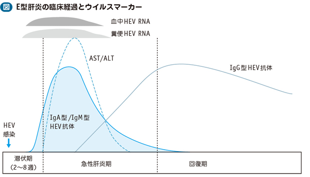 06_04_E型肝炎