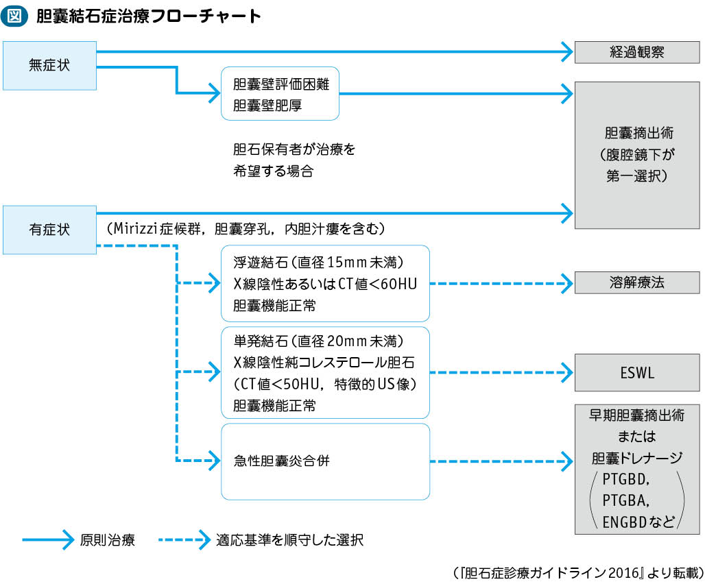 胆嚢結石症 電子コンテンツ 日本医事新報社