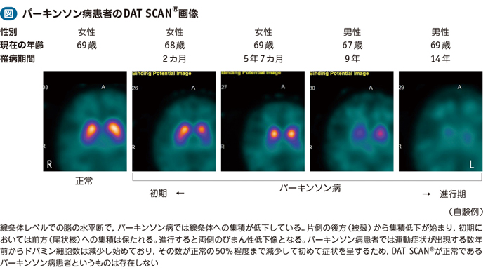 パーキンソン病 電子コンテンツ 日本医事新報社