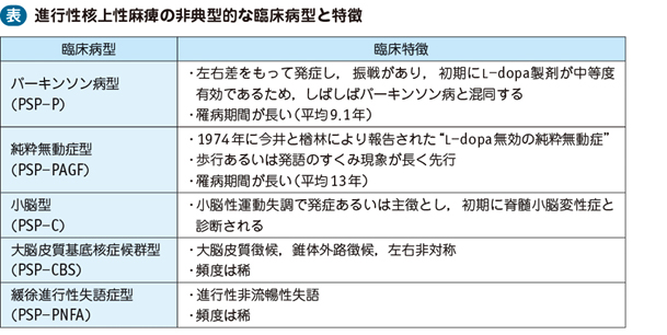 性 上 麻痺 余命 核 進行 性 進行性核上性麻痺という病気について～症状編～