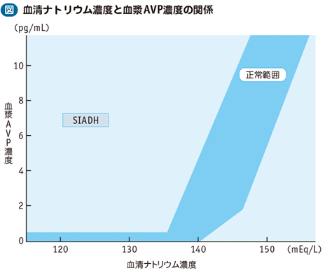 10_05_ADH不適切分泌症候群