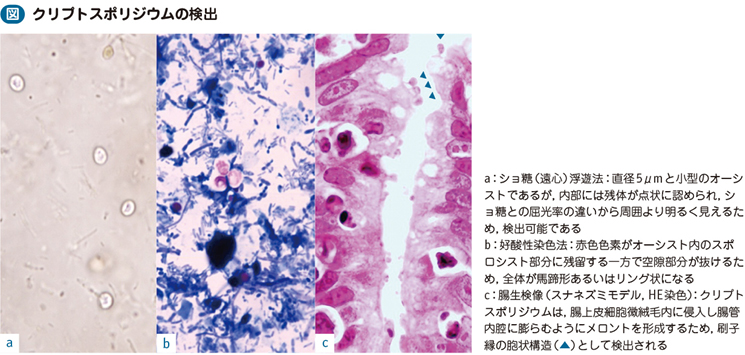 13_03_クリプトスポリジウム症