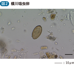 13_13_横川吸虫症（有害異形吸虫症を含む）