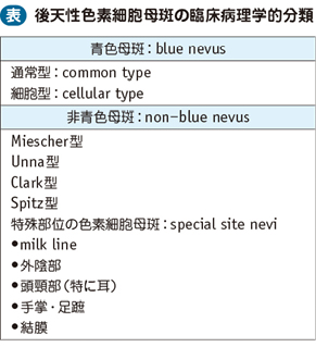 14_63_後天性色素細胞母斑（ほくろ）
