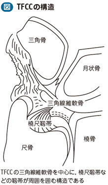 15_16_三角線維軟骨複合体損傷（TFCC損傷）