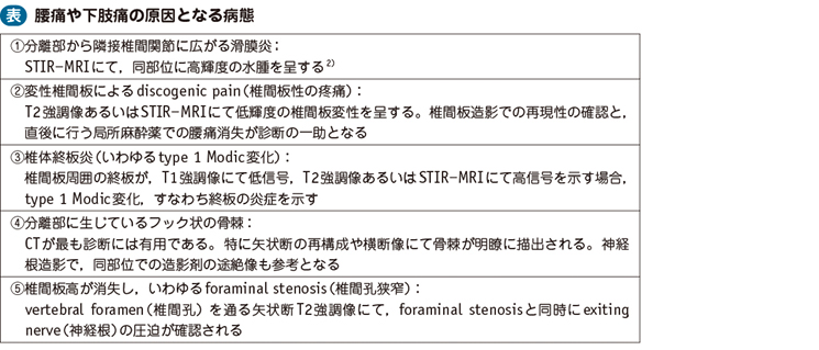 15_31_成人腰椎分離症・分離すべり症