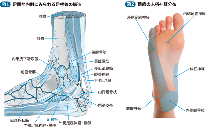 足根管症候群 電子コンテンツ 日本医事新報社