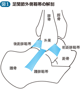 15_70_捻挫