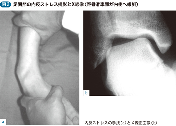 捻挫 電子コンテンツ 日本医事新報社