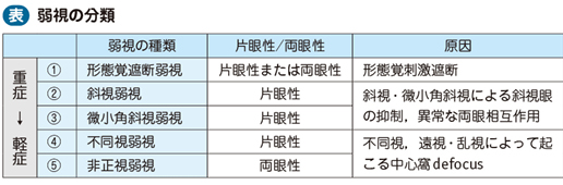 弱視|電子コンテンツ|日本医事新報社 弱視|電子コンテンツ|日本医事新報社