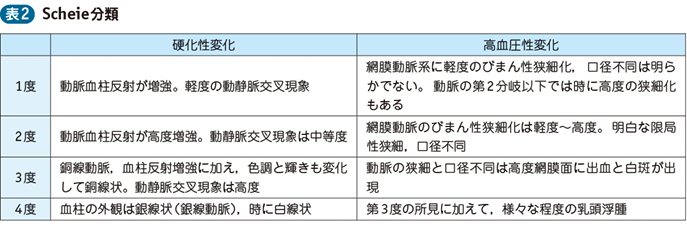 17_50_高血圧網膜症