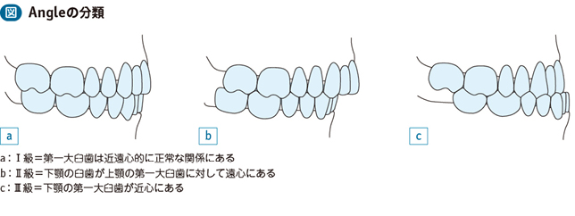 19_21_不正咬合