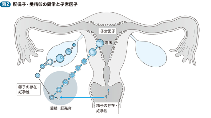 勃起不全に苦しんでいます