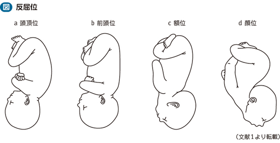 胎勢異常 回旋異常 電子コンテンツ 日本医事新報社