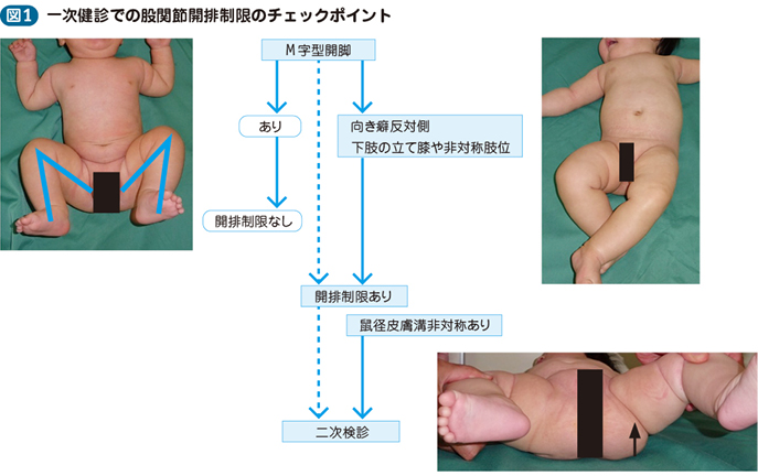 M字　二次 