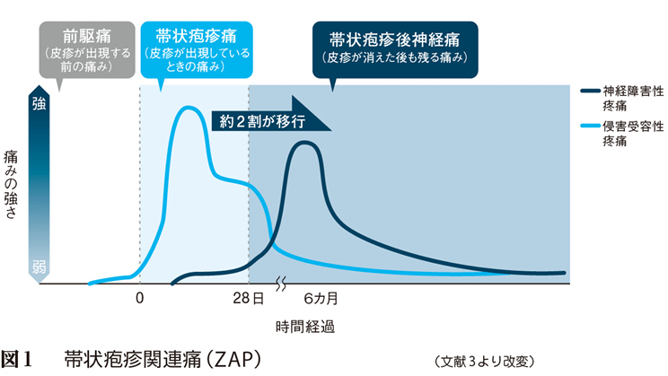 疱疹 神経痛 帯状 後