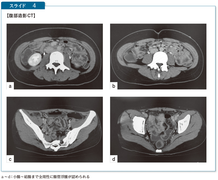 Case13 急性の胃腸症状で入院後に意識変容をきたした歳 女性 電子コンテンツ 日本医事新報社