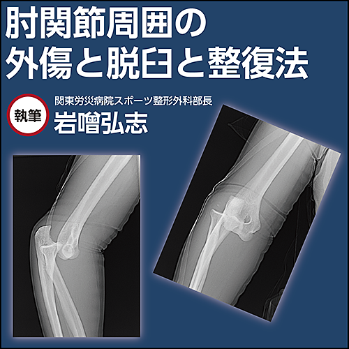 肘関節周囲の外傷と脱臼と整復法 電子コンテンツ 日本医事新報社