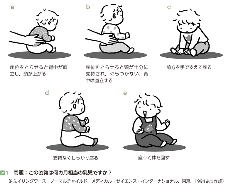 Case1 子どもの発育 発達を考えよう 電子コンテンツ 日本医事新報社