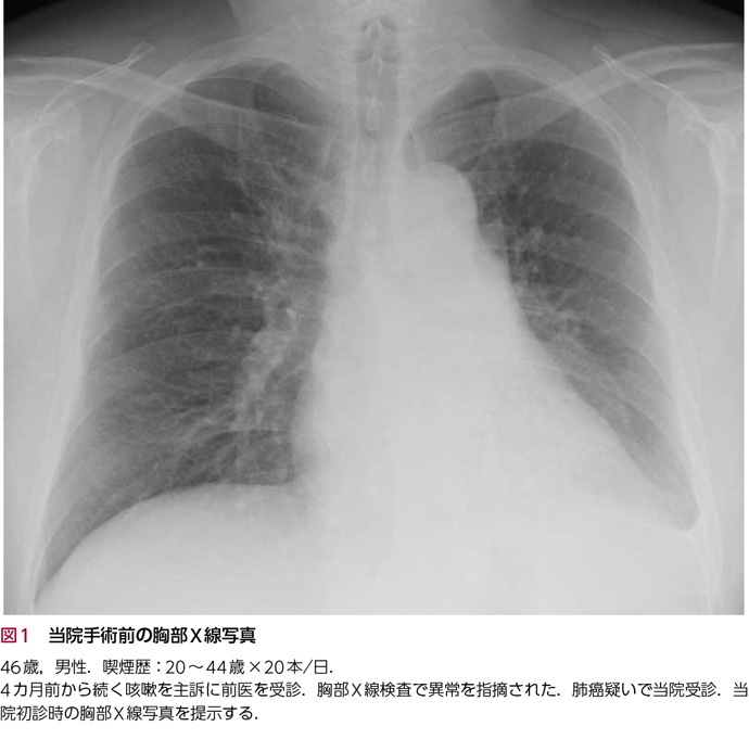 11 胸部x線 読影セミナー Web医事新報 日本医事新報社