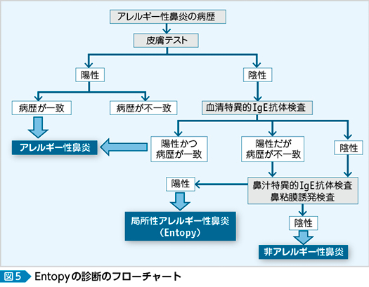 アレルギー 性 鼻炎