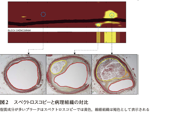 無料ダウンロード 稲城 アイバス 人気のある画像を投稿する