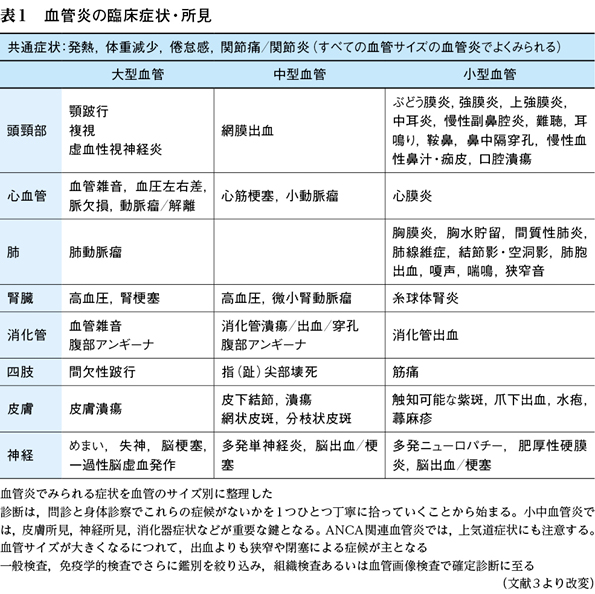 血管 anca 炎 関連 血管炎症候群