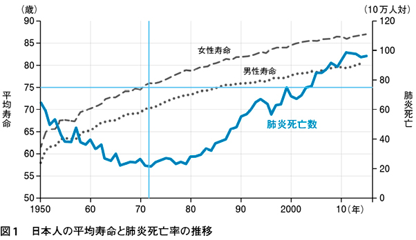 肺炎 余命 者 性 高齢 誤 嚥 高齢者肺炎にも緩和ケアの概念を｜特集◎その肺炎 治す？