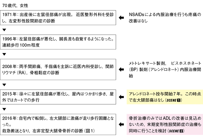 股関節 症 性 名医 変形