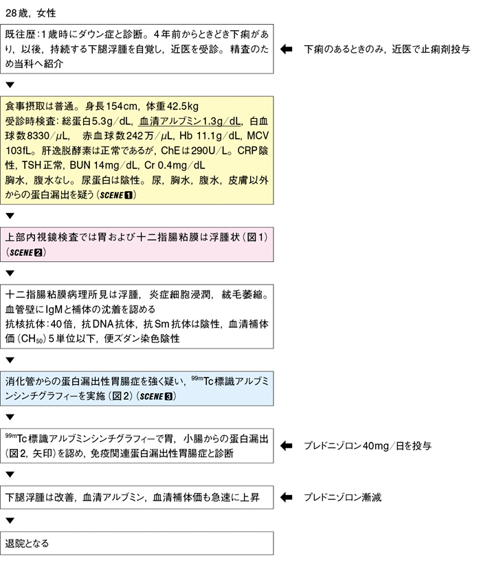 性 蛋白 症 漏出 胃腸