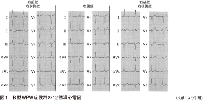 ddx勃起不全