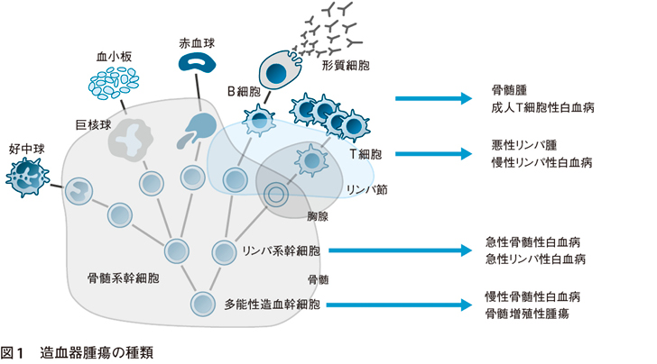 アトラス 造血器腫瘍アトラス 形態、免疫、染色体から分子細胞治療へ