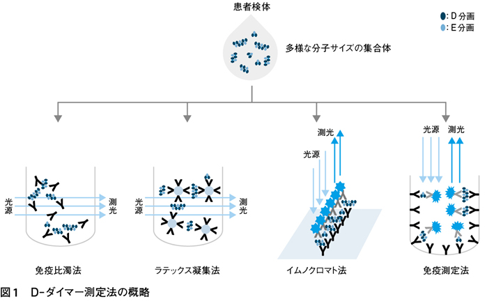 ダイマー 高値 d 【深部静脈血栓症】 3つの重要な検査（D