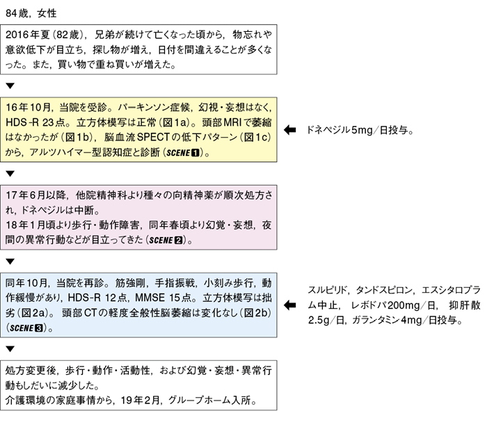 アルツハイマー 型 認知 症