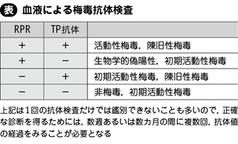 神経 梅毒 症状