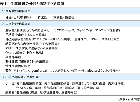 肝臓の手 手掌紅斑 Web医事新報 日本医事新報社