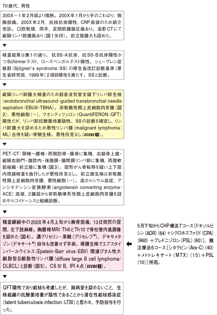 シェーグレン 症候群 診断