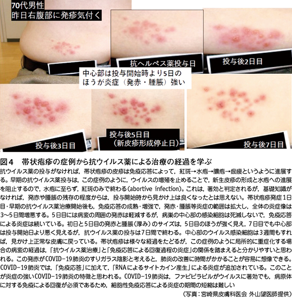 緊急寄稿 4 新型コロナウイルス感染症 Covid 19 に対するアビガン承認に向けて 白木公康 Web医事新報 日本医事新報社