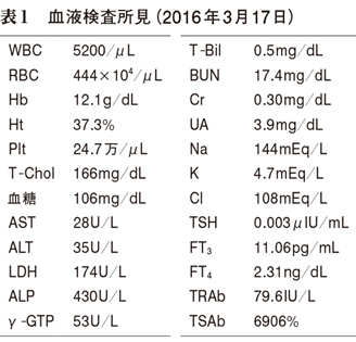 Tsh低値の甲状腺機能亢進症へのチアマゾール投与の指標はft3のみでよいか Web医事新報 日本医事新報社