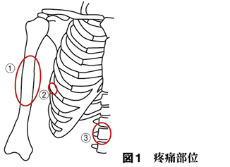 右脇腹が痛い69歳女性 鑑別診断塾入門 11 Web医事新報 日本医事新報社