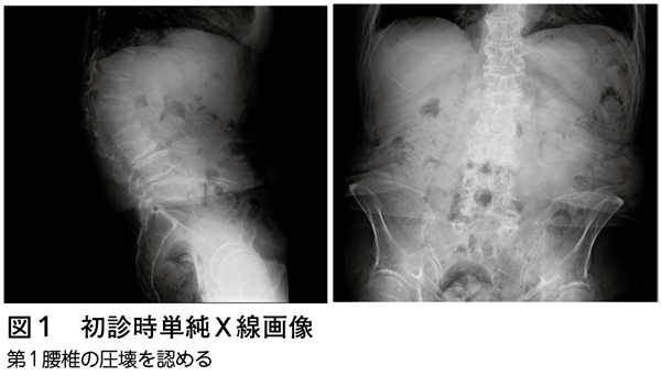 Amazon.co.jp: 基本腰椎外科手術書 : 辻 陽雄: 本